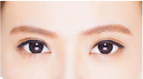 雙眼皮修復(fù)成功率高嗎?什么時(shí)候修復(fù)雙眼皮比較好?