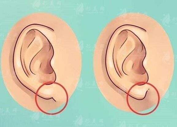 北京八大處耳再造費(fèi)用多少錢