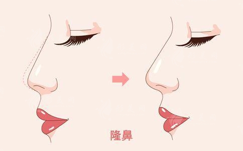 重慶李喆怎么預(yù)約掛號？