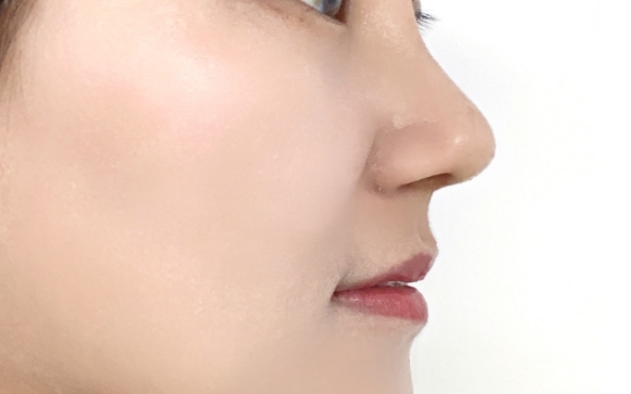 隆鼻材料大盤點(diǎn)，看完這篇知道怎么選了吧~