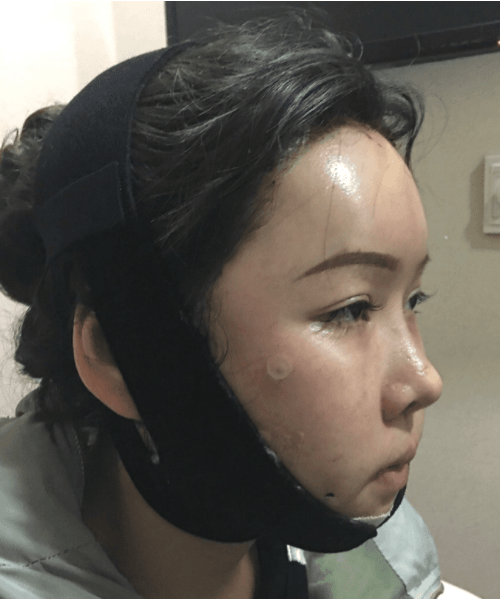 北京八大處磨骨多少錢？2022價(jià)格表曝光+磨骨案例