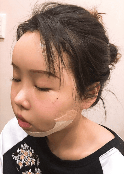 北京八大處磨骨多少錢？2022價(jià)格表曝光+磨骨案例