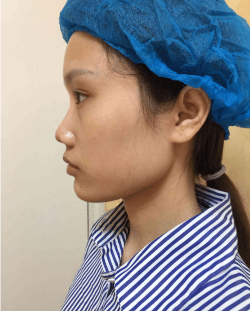 四川省成都軍建醫(yī)院怎么樣？價(jià)格表曝光+隆鼻真人案例分享