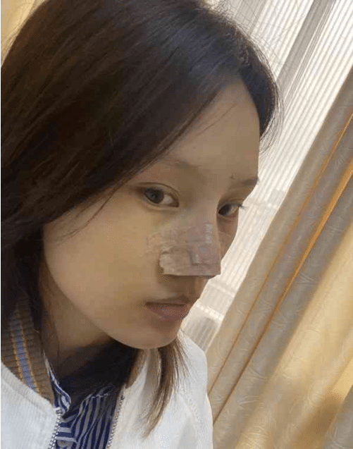 四川省成都軍建醫(yī)院怎么樣？價(jià)格表曝光+隆鼻真人案例分享