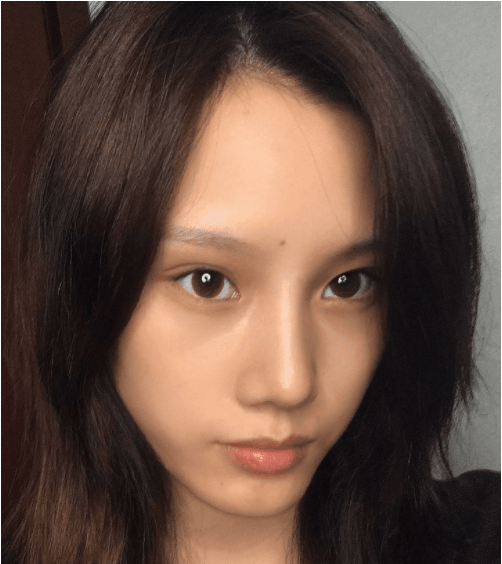 四川省成都軍建醫(yī)院怎么樣？價(jià)格表曝光+隆鼻真人案例分享