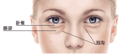 臥蠶和眼袋究竟有啥區(qū)別？看完你就會明白