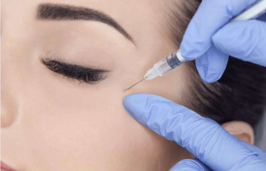 除皺針注射效果怎么樣