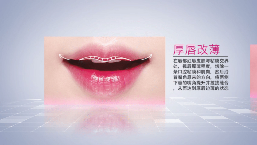 厚嘴唇的原因是什么?影響嘴唇形狀的不好習(xí)慣有哪些?