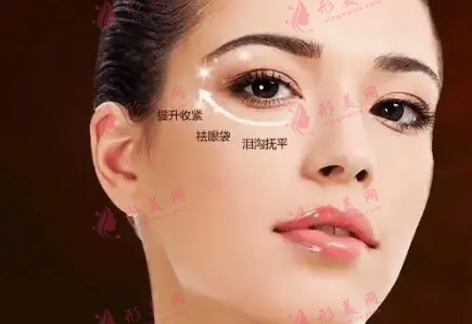 上海九院祛眼袋價(jià)格表