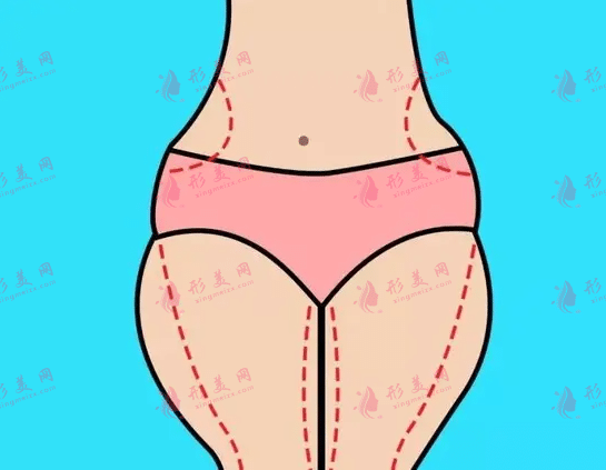 上海九院吸脂價(jià)格