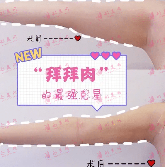 抽脂手臂的價(jià)格是多少?