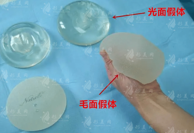 內(nèi)窺鏡豐胸手術恢復期長不長? 內(nèi)窺鏡豐胸手術恢復期長不長?