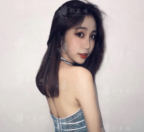 武漢五洲整形美容醫(yī)院面部提升價(jià)格貴嗎？收費(fèi)表及案例公布