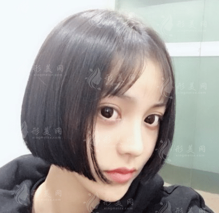 長春韓尚植發(fā)醫(yī)院怎么樣？2022發(fā)際線種植案例展示