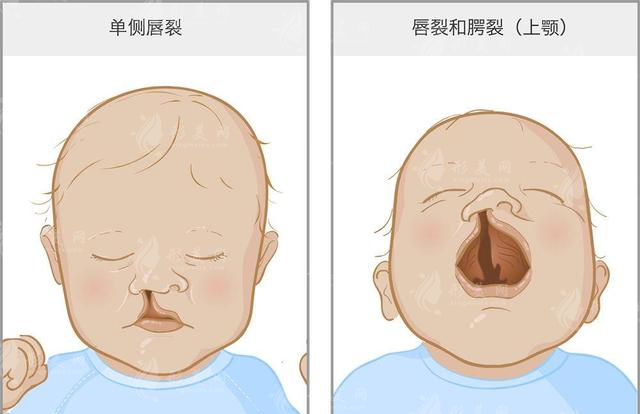 王馳做唇腭裂技術(shù)好嗎？