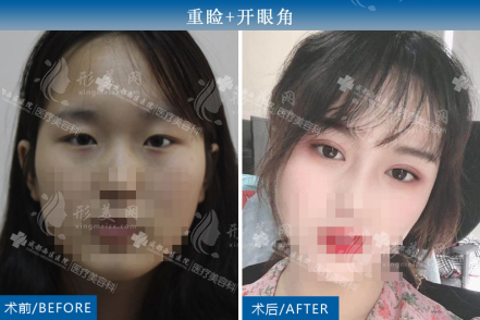 楊世界案例展示