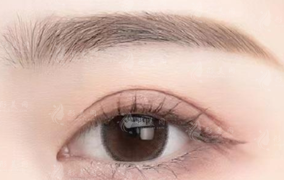 北京麗都整形醫(yī)院做雙眼皮怎么樣？醫(yī)生信息+案例分享+價格預(yù)覽