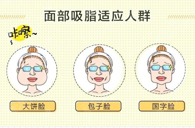 面部吸脂效果怎么樣？面部吸脂適用于所有人嗎？
