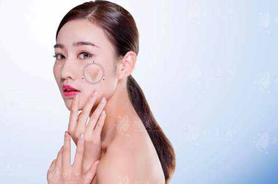 面部吸脂效果怎么樣？面部吸脂適用于所有人嗎？