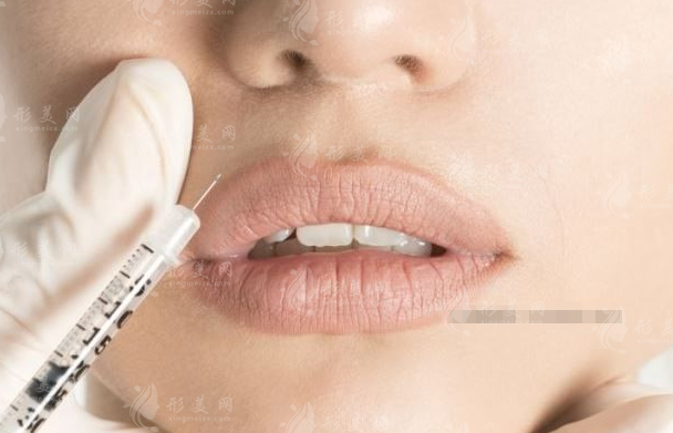常見的唇部整形手術(shù)方法有哪些？唇部填充術(shù)、唇部提升術(shù)…