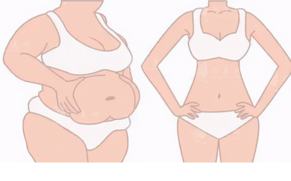 西安葉子整形吸脂怎么樣？醫(yī)生技術資料|案例分享|價格表