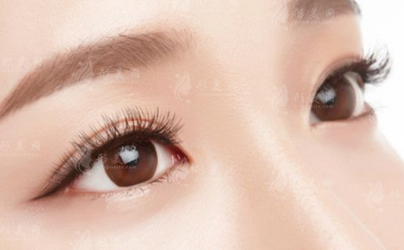 雙眼皮割寬了能修復(fù)嗎？修復(fù)方法是什么？