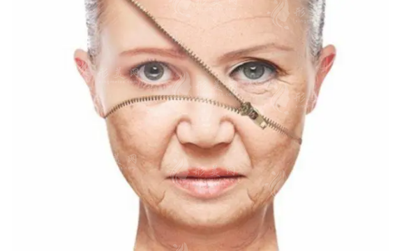 想要告別皺紋？電波拉皮全面解讀！