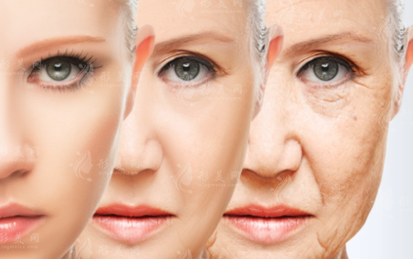 想要告別皺紋？電波拉皮全面解讀！