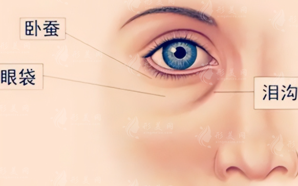 自體脂肪填充淚溝有弊端和風(fēng)險嗎？一起來看看吧~