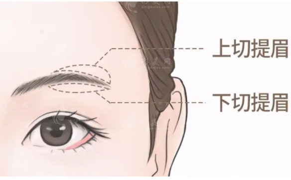 切眉和提眉有啥區(qū)別？本文為你解答