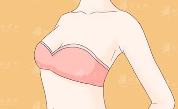 乳房再造手術(shù)的安全性和潛在風(fēng)險(xiǎn)有哪些？