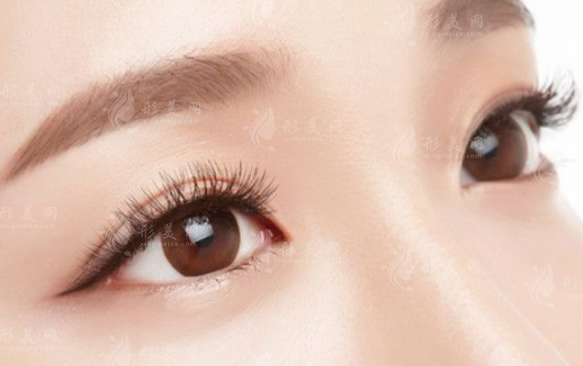 去眼袋可以和雙眼皮手術(shù)一起做嗎？ 一起來看看吧