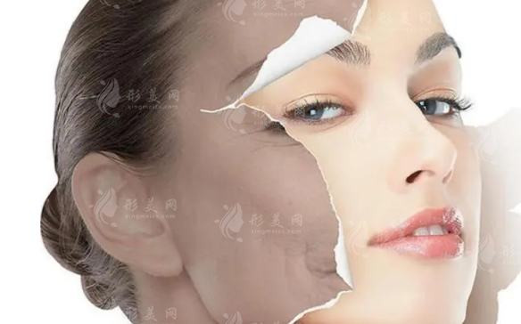 黃金微針VS微針，你分的清楚區(qū)別嗎？