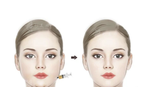 北京八大處面部吸脂多少錢？專家介紹\案例分享\附收費明細~