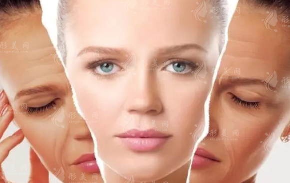 大拉皮除皺手術(shù)效果能持續(xù)多久？原理是什么？