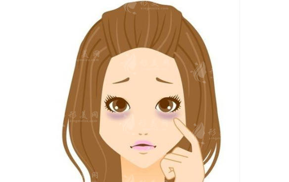 激光去黑眼圈需要多長(zhǎng)時(shí)間？注意事項(xiàng)一覽