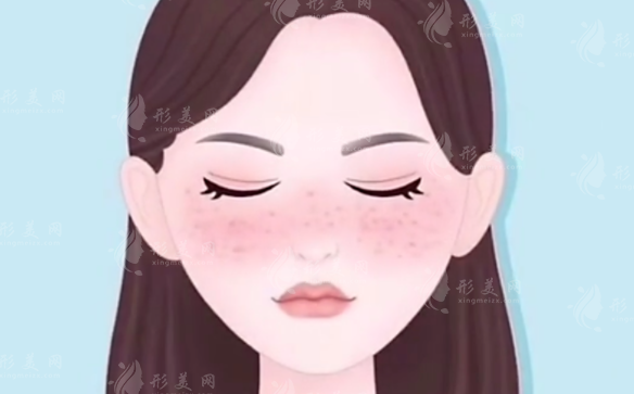 超皮秒祛斑會反彈嗎？有什么副作用？