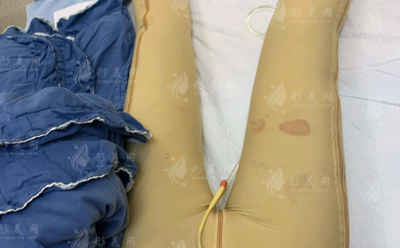 北京八大處大腿吸脂多少錢？好評醫(yī)生|案例介紹|整形價格一覽~