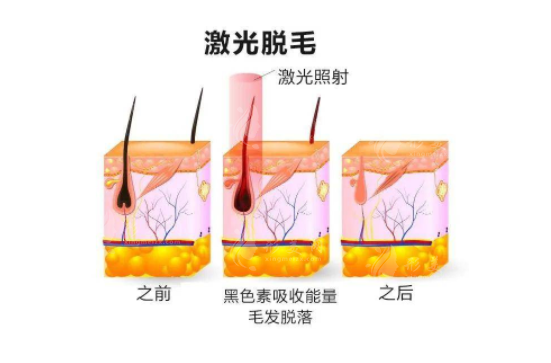 上海九院激光脫毛治療價(jià)格表