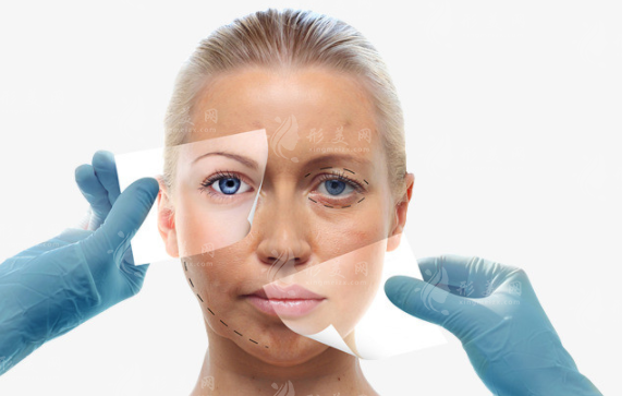 小切口拉皮除皺主要針對哪些皺紋？手術(shù)效果好嗎？