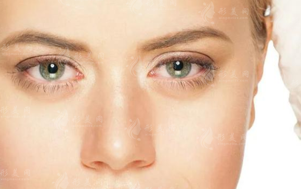 自體脂肪填充淚溝能保持多久？優(yōu)點(diǎn)有哪些？