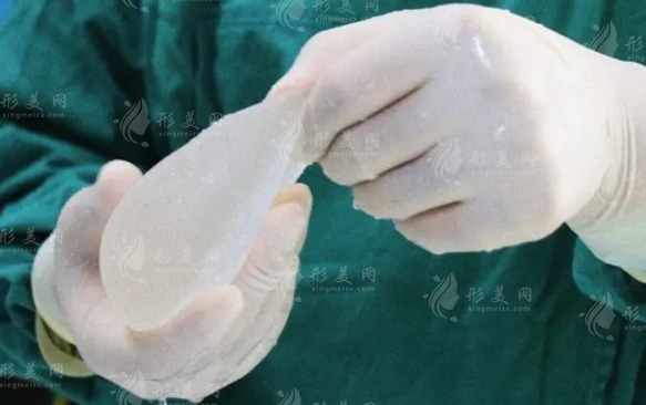 假體隆胸手術(shù)能做局麻嗎？局麻好還是全麻好？