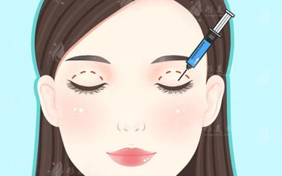 蘇州美萊雙眼皮整形多少錢？醫(yī)生信息、整形價(jià)格表分享