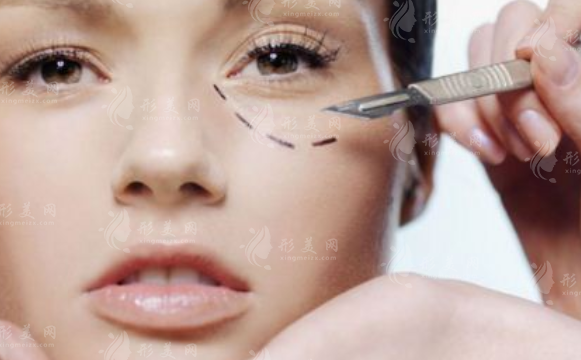 豐臥蠶有哪些方法？術(shù)后有后遺癥嗎？