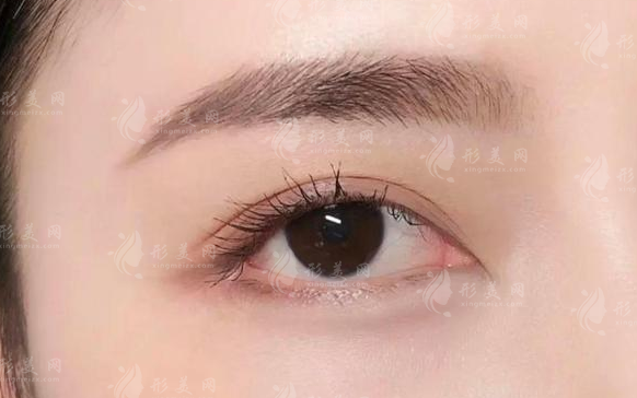 眉毛種植一般需要多少錢(qián)？術(shù)后注意事項(xiàng)有哪些？