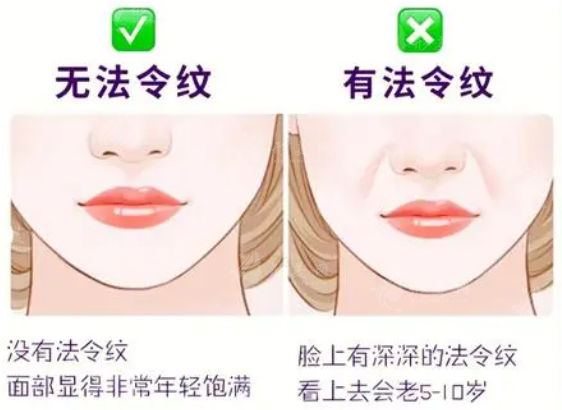 上海去除法令紋哪家醫(yī)院好？