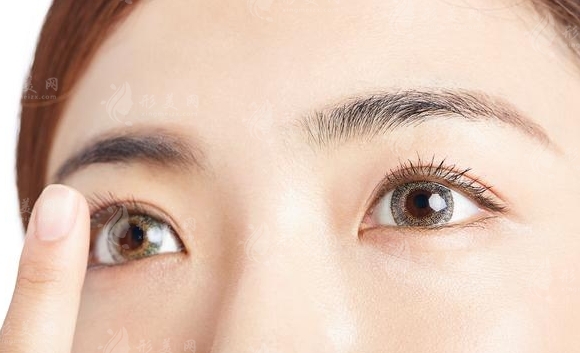 雙眼皮埋線般需要多少錢(qián)？做完能維持幾年？