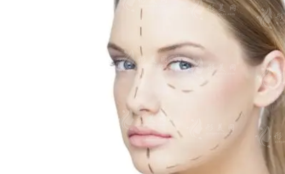 鼻尖整形需要多少錢?術(shù)后應(yīng)該注意什么呢?