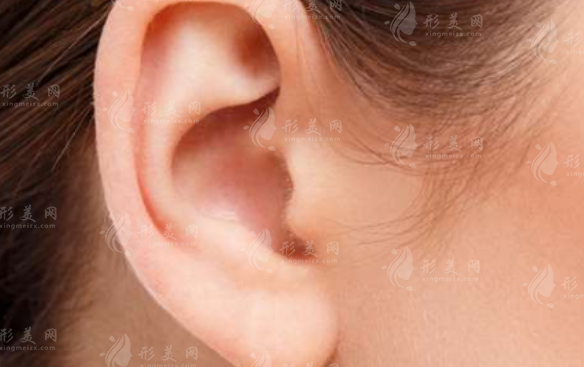 豐耳垂的兩種常用手術(shù)方法是哪些？