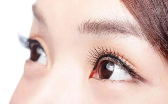 北京豐聯(lián)麗格師麗麗雙眼皮修復(fù)多少錢？優(yōu)勢介紹、收費(fèi)價格